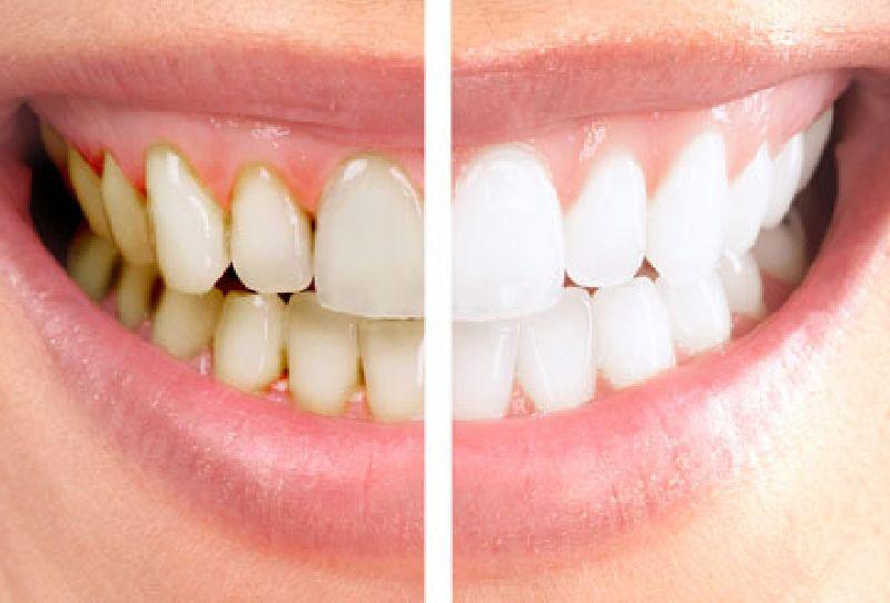 DENTI1-1.jpeg DENTI1-1.jpeg