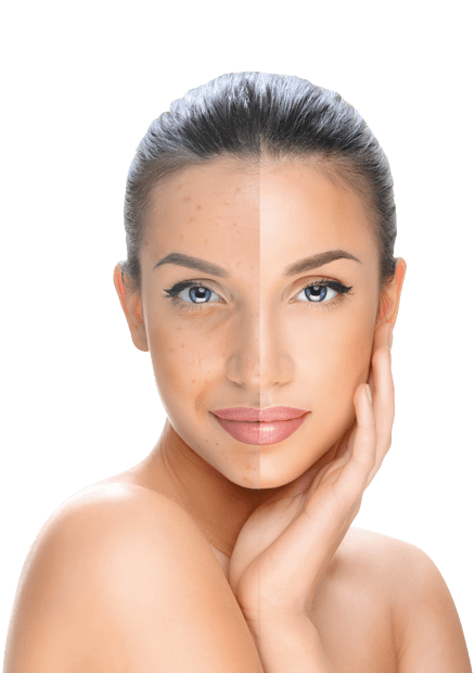 piperina-woman-1.png piperina-woman-1.png